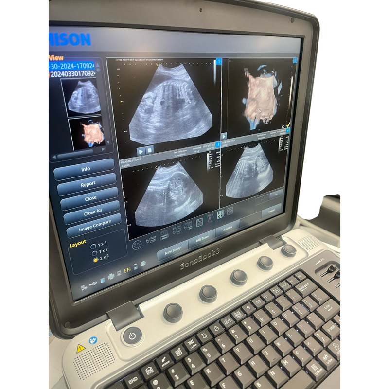 Chison SonoBook9 4D Ultrasound w/4D Convex Probe, Abdominal, OBGYN - Manf 2023