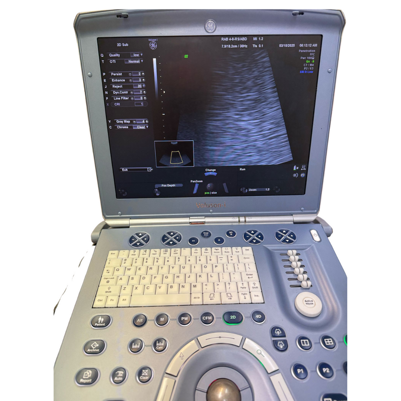 GE Volusion i Portable Ultrasound w/Conex Probe 3D/4D - Excellent Conditions