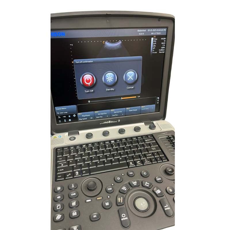 Chison SonoBook9 4D Ultrasound w/4D Convex Probe, Abdominal, OBGYN - Manf 2023