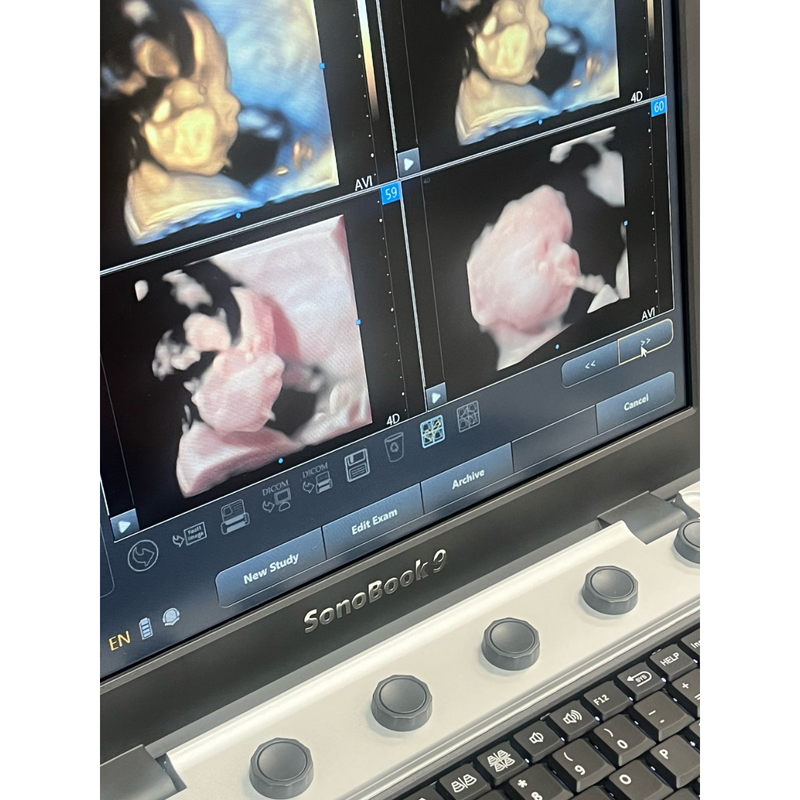 Chison SonoBook9 4D Ultrasound w/4D Convex Probe, Abdominal, OBGYN - Manf 2023