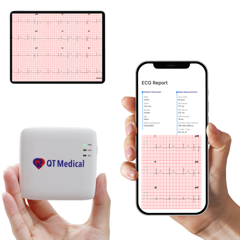 QT Medical PCA 500 Wireless 12-Lead EKG Recorder Ultra Portable (Only 2.36 oz!) w/Interpretation