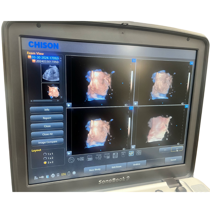 Chison SonoBook9 4D Ultrasound w/4D Convex Probe, Abdominal, OBGYN - Manf 2023