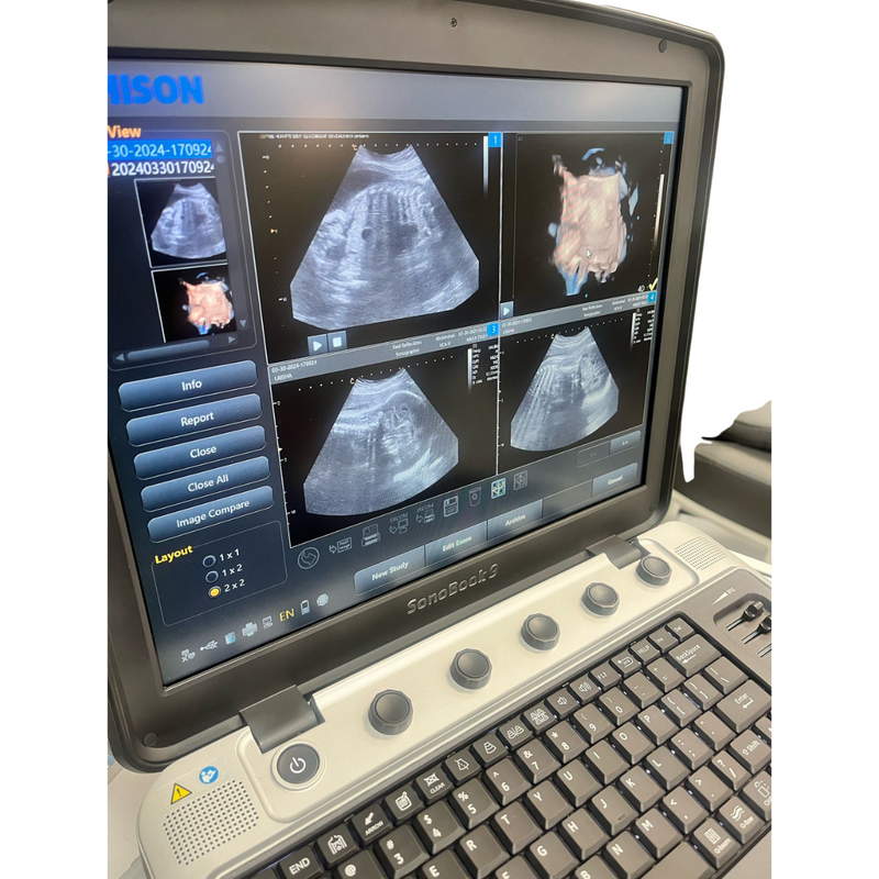 Chison SonoBook9 4D Ultrasound w/4D Convex Probe, Abdominal, OBGYN - Manf 2023