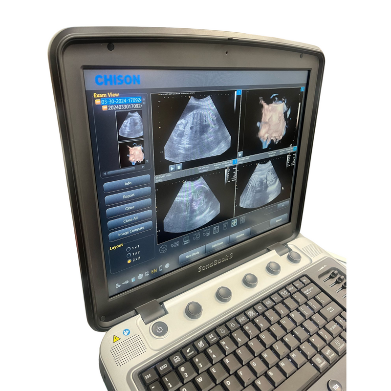 Chison SonoBook9 4D Ultrasound w/4D Convex Probe, Abdominal, OBGYN - Manf 2023