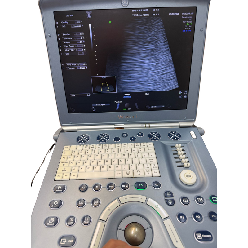 GE Volusion i Portable Ultrasound w/Conex Probe 3D/4D - Excellent Conditions