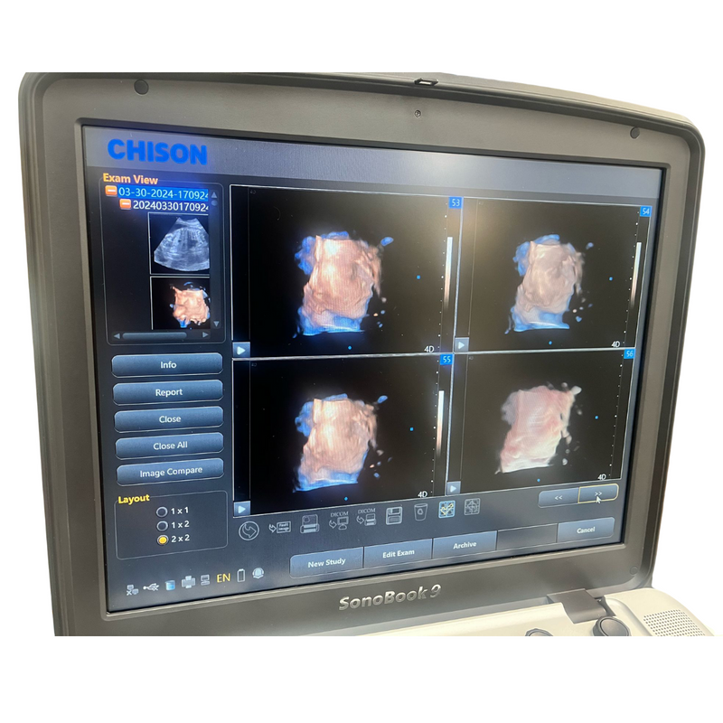 Chison SonoBook9 4D Ultrasound w/4D Convex Probe, Abdominal, OBGYN - Manf 2023