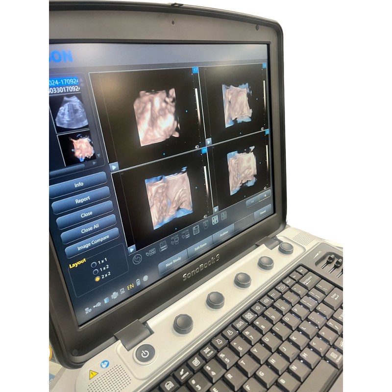 Chison SonoBook9 4D Ultrasound w/4D Convex Probe, Abdominal, OBGYN - Manf 2023