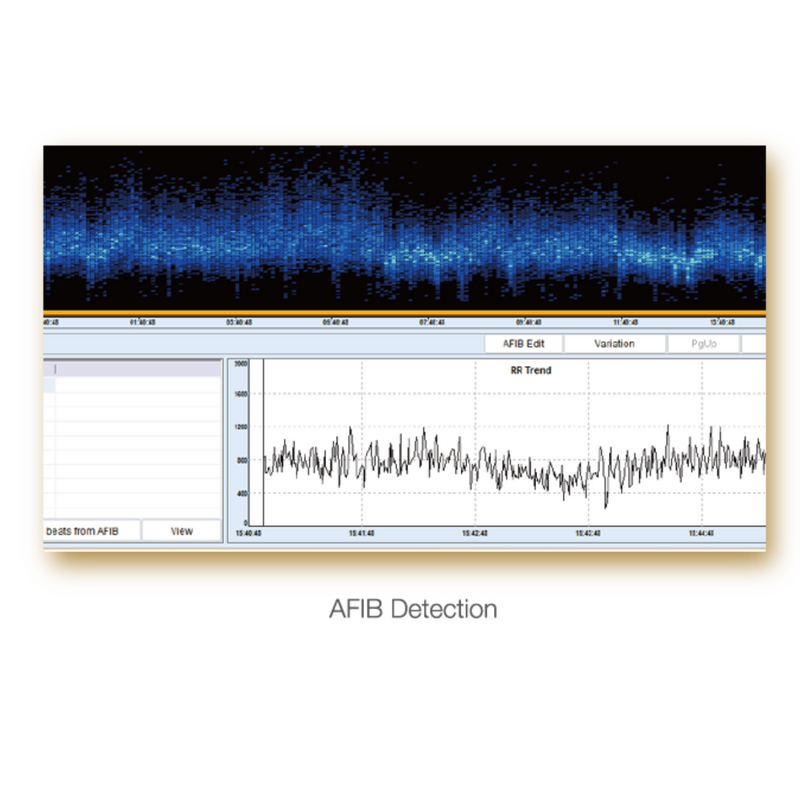 EDAN SE-2012 12-Channel Holter System w/Analysis Software