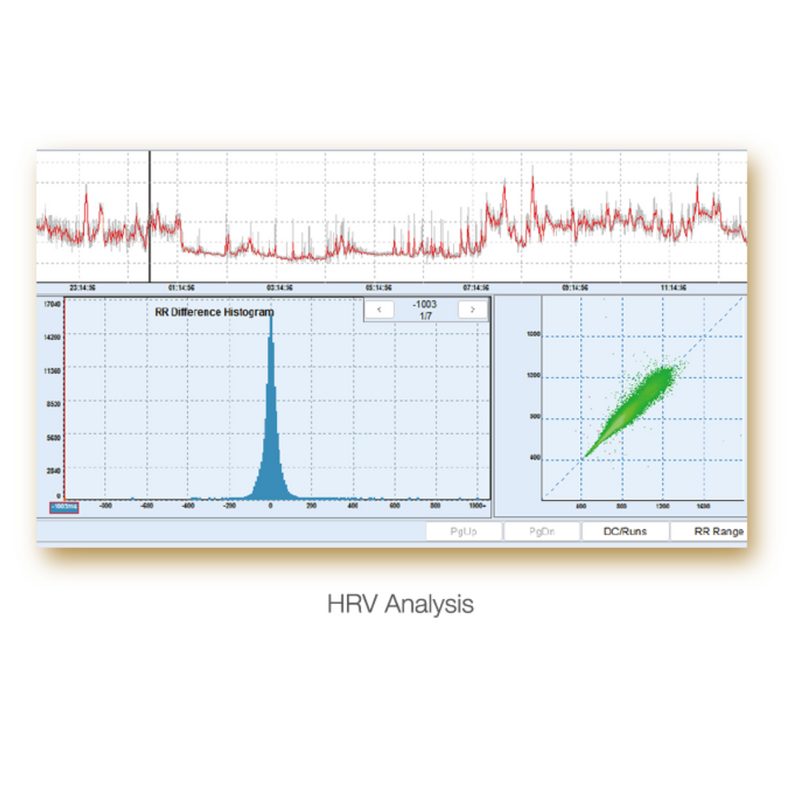 EDAN SE-2012 12-Channel Holter System w/Analysis Software