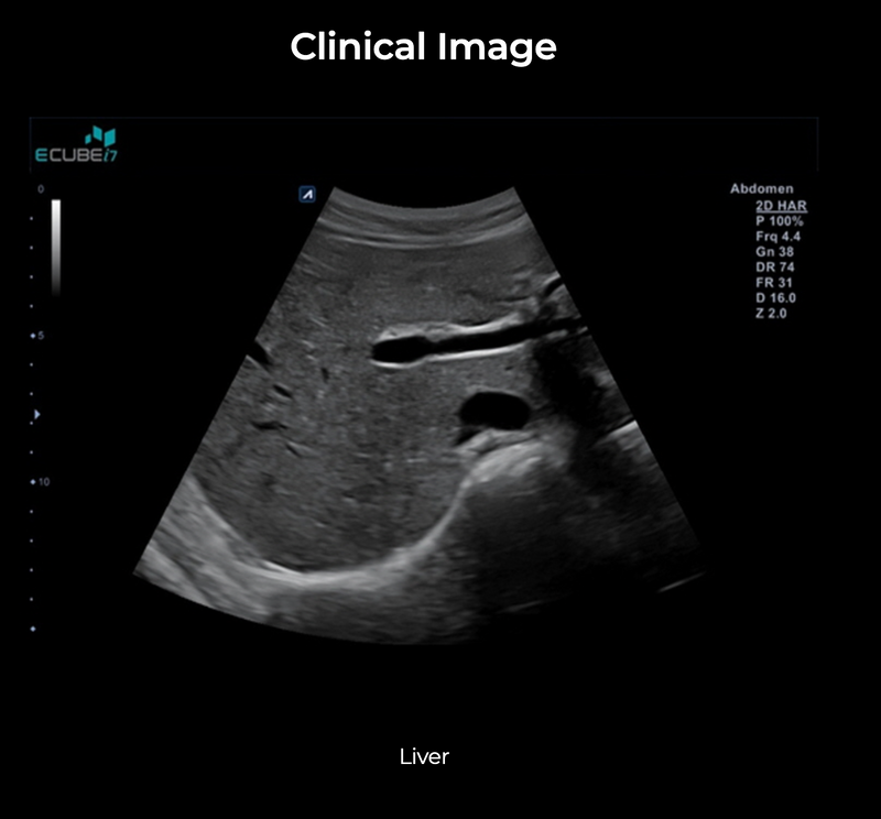 Alpinion ECube i7 Ultrasound Fully Serviced, All Application Open, 3 Probes