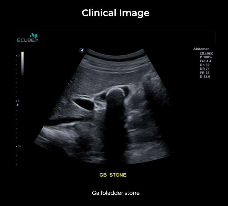 Alpinion ECube i7 Ultrasound Fully Serviced, All Application Open, 3 Probes