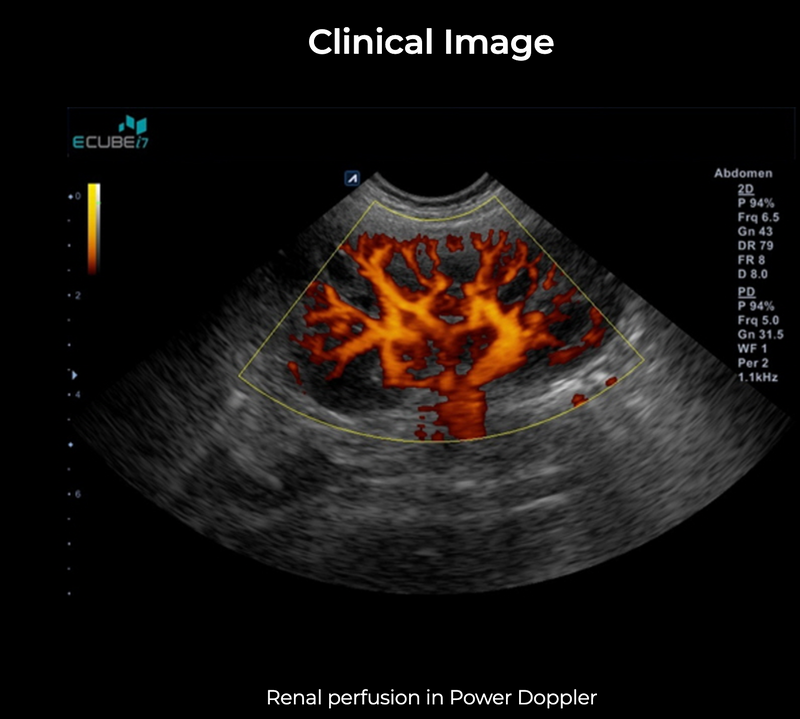 Alpinion ECube i7 Ultrasound Fully Serviced, All Application Open, 3 Probes