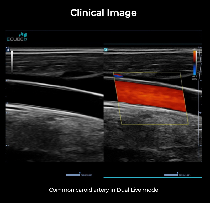 Alpinion ECube i7 Ultrasound Fully Serviced, All Application Open, 3 Probes