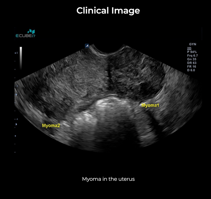 Alpinion ECube i7 Ultrasound Fully Serviced, All Application Open, 3 Probes