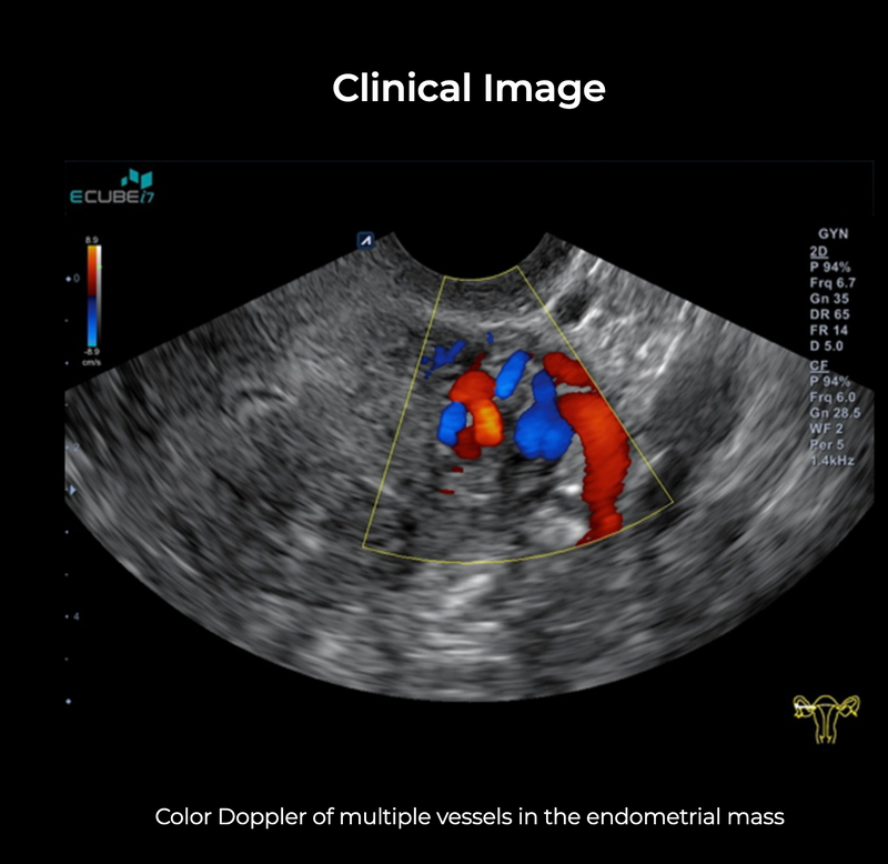 Alpinion ECube i7 Ultrasound Fully Serviced, All Application Open, 3 Probes