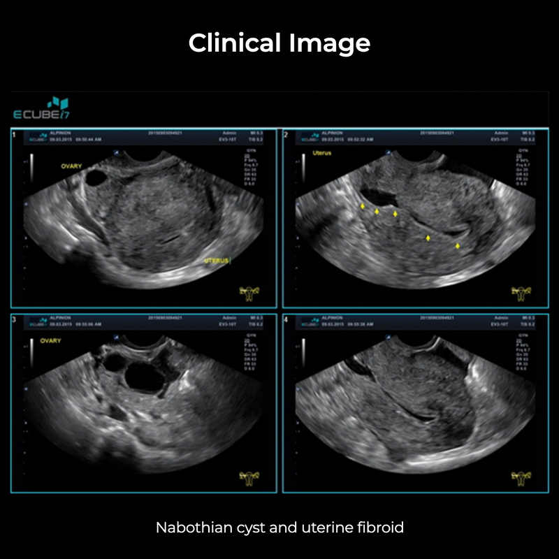 Alpinion ECube i7 Ultrasound Fully Serviced, All Application Open, 3 Probes