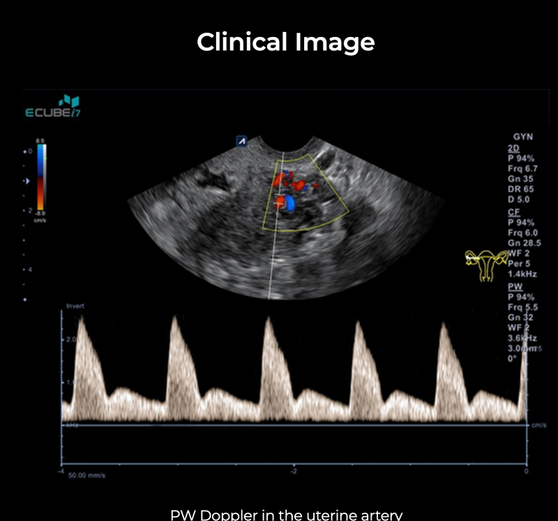 Alpinion ECube i7 Ultrasound Fully Serviced, All Application Open, 3 Probes