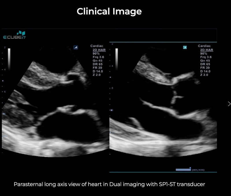 Alpinion ECube i7 Ultrasound Fully Serviced, All Application Open, 3 Probes