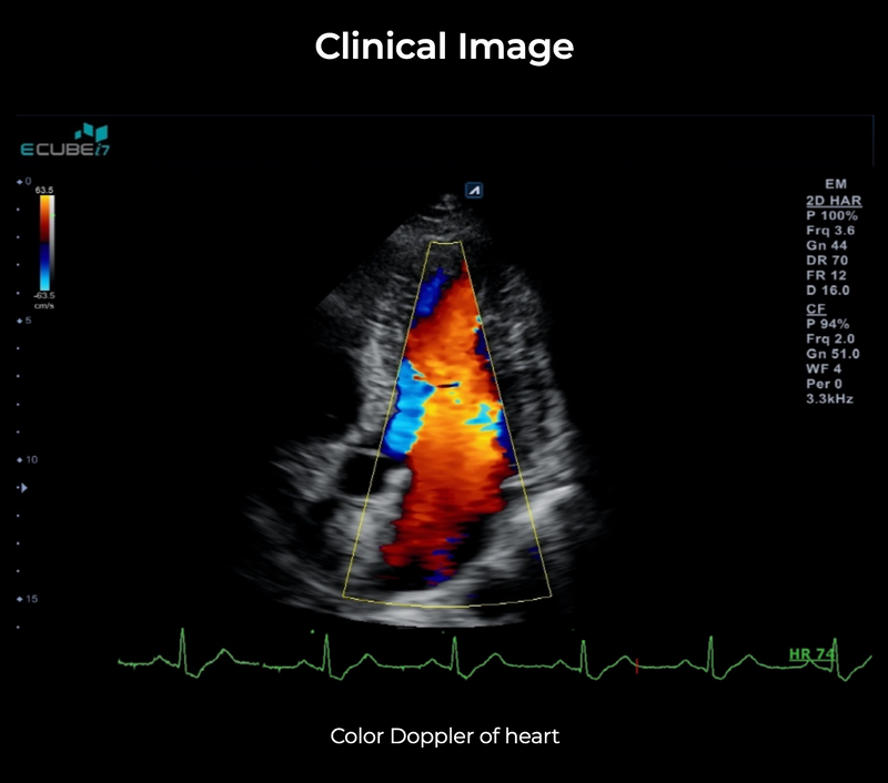 Alpinion ECube i7 Ultrasound Fully Serviced, All Application Open, 3 Probes