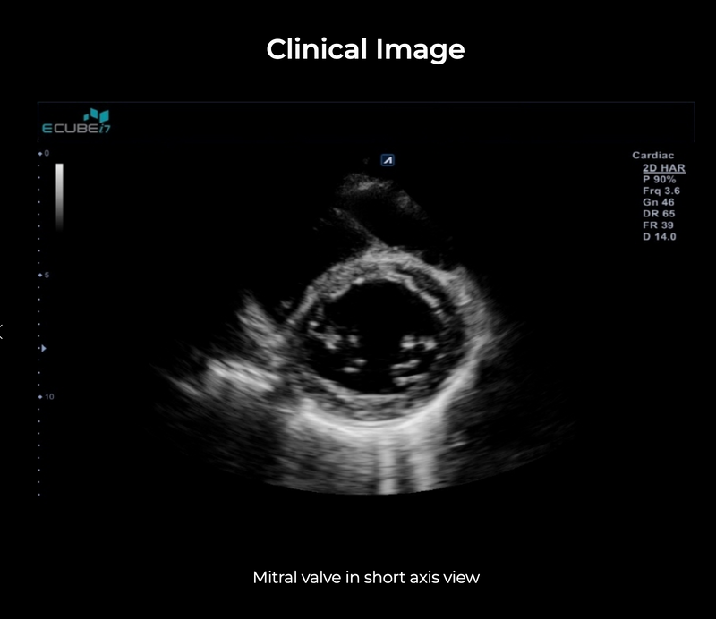 Alpinion ECube i7 Ultrasound Fully Serviced, All Application Open, 3 Probes