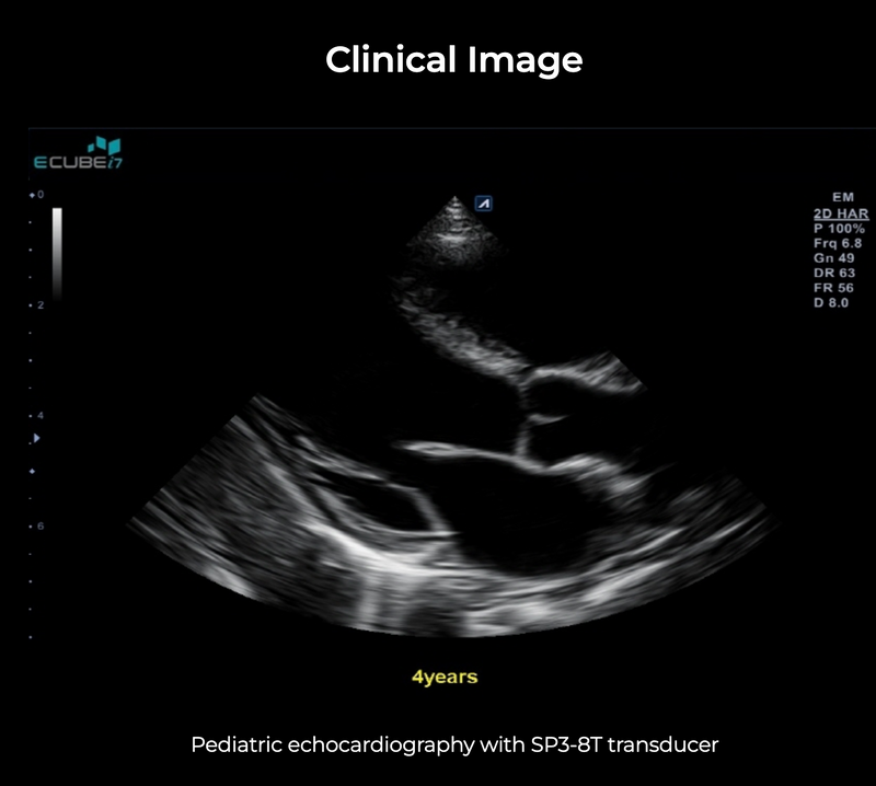 Alpinion ECube i7 Ultrasound Fully Serviced, All Application Open, 3 Probes