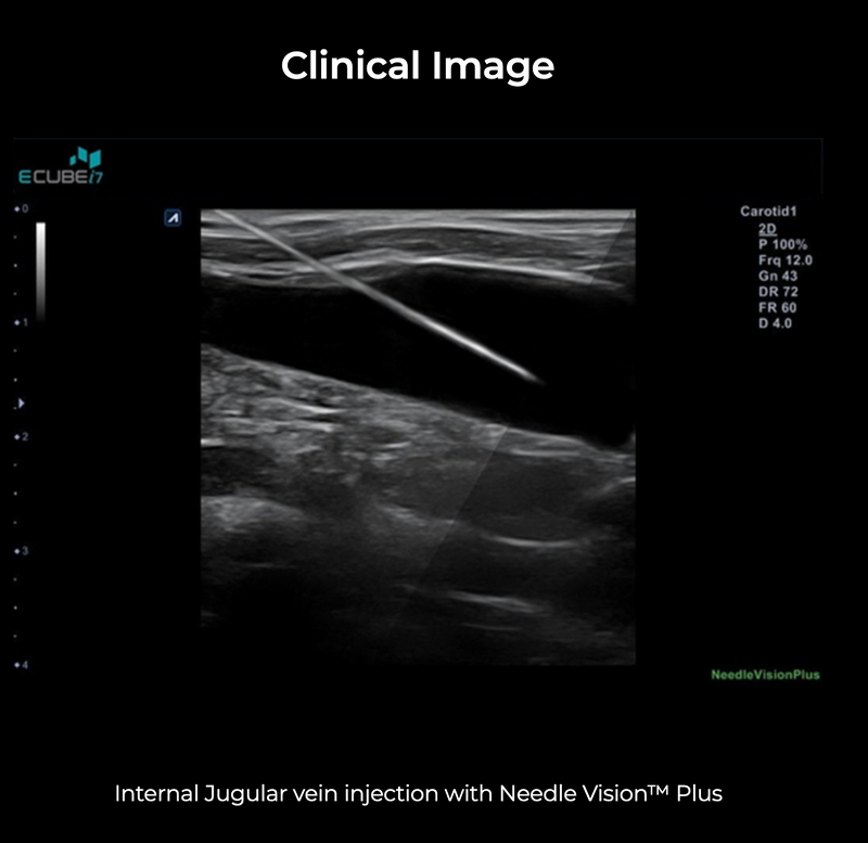 Alpinion ECube i7 Ultrasound Fully Serviced, All Application Open, 3 Probes