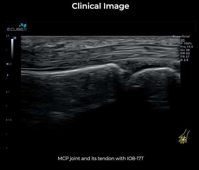 Alpinion ECube i7 Ultrasound Fully Serviced, All Application Open, 3 Probes