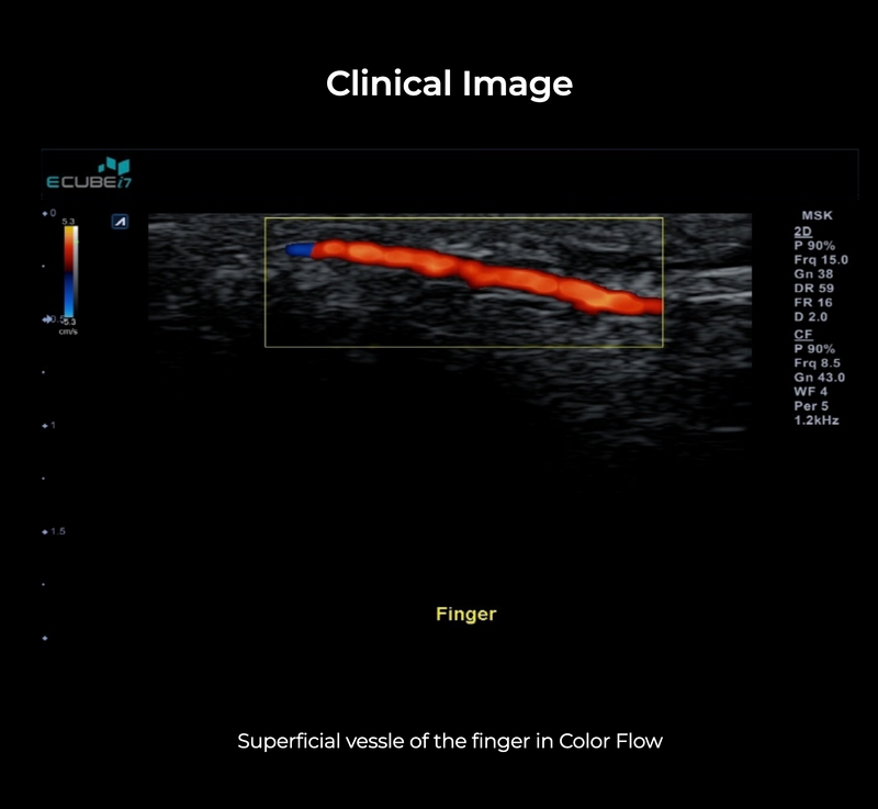 Alpinion ECube i7 Ultrasound Fully Serviced, All Application Open, 3 Probes